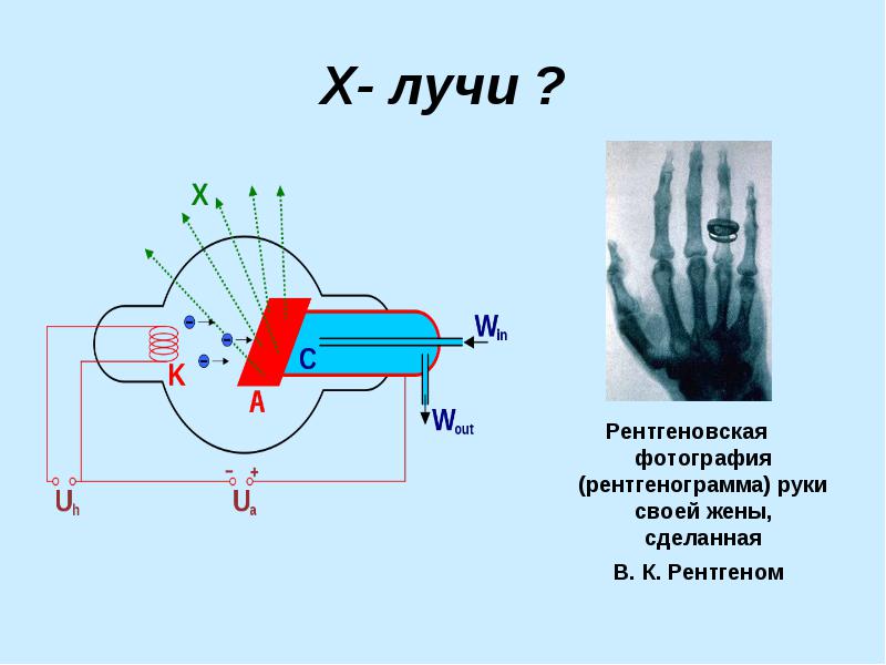 Х - лучи или открытие Рентгена